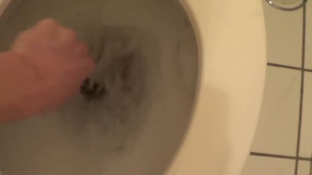 How To Perform Open Heart Surgery смотреть онлайн