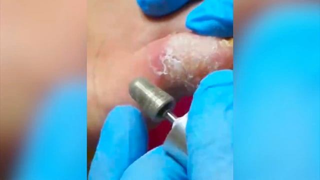 Что бывает от спецобуви??? смотреть онлайн