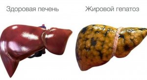 Лучшие Упражнения Для ПЕЧЕНИ