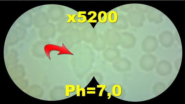 ГЕМОСКАНИРОВАНИЕ. Какая кровь под микроскопом, если в моче PH=7,0? Гемосканирование. Кровь. смотреть онлайн
