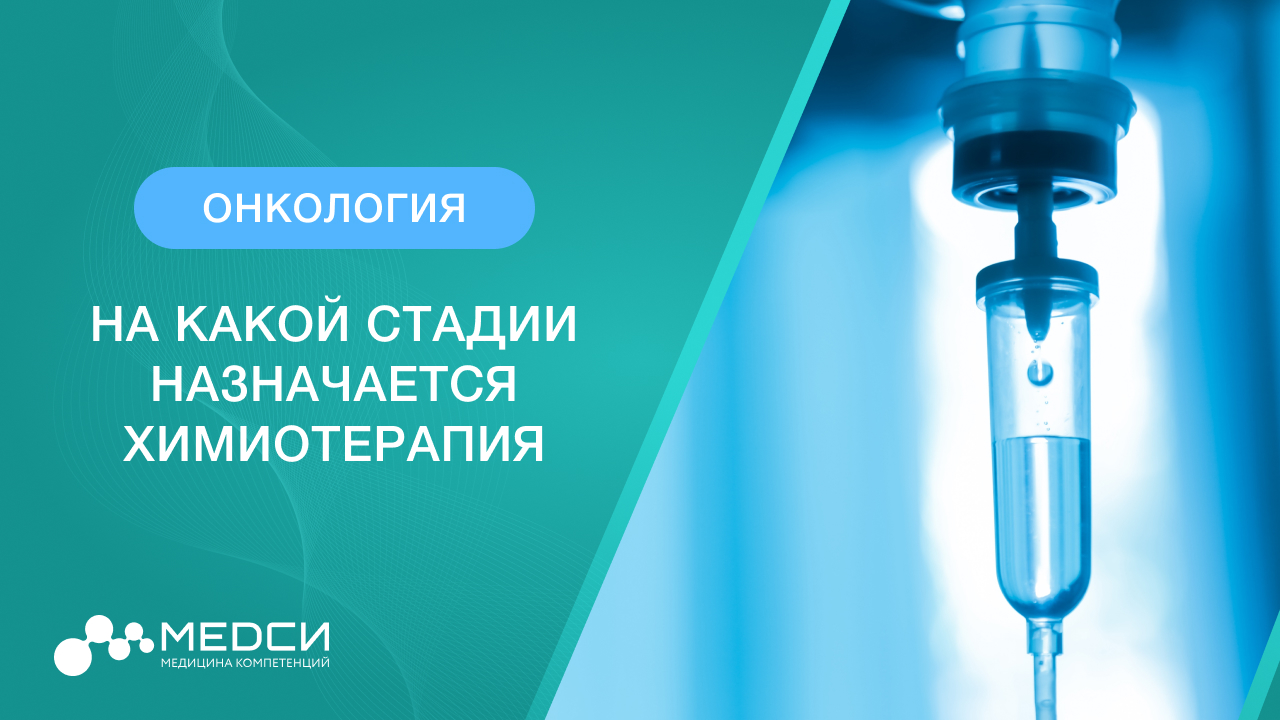 Химиотерапия и рак. На какой стадии назначается химиотерапия? смотреть онлайн