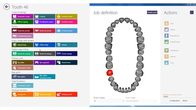 EXOCAD TUTORIAL - Dental-Teaser-The NEW Exocad Orderlist in Windows 8 Design смотреть онлайн
