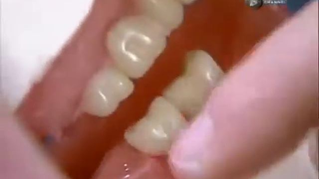 Искусственные зубы «Как это работает» №86 смотреть онлайн