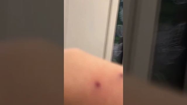 Как кусаются попугаи Монахи? смотреть онлайн