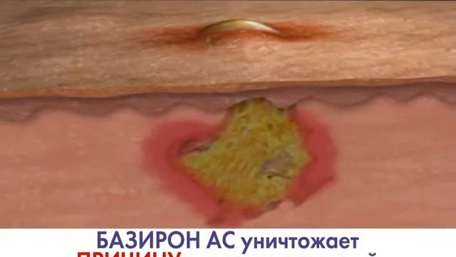 ZDOROV BAZIRON смотреть онлайн