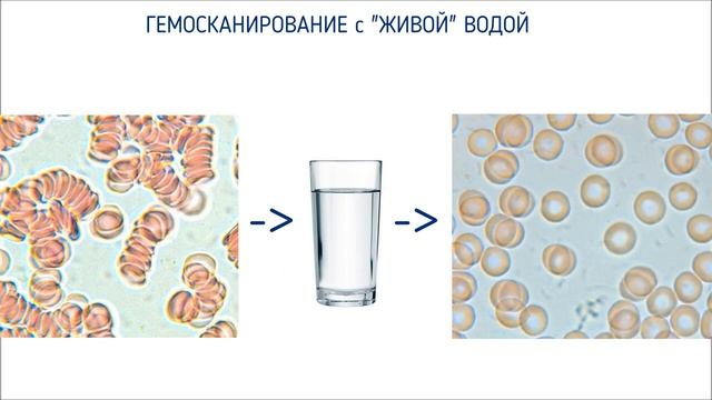 ВОДА ЦЕЛИТЕЛЬ. Как вода влияет на здоровье. И как приготовить целебную воду. смотреть онлайн