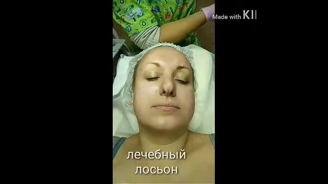 Чистка лица