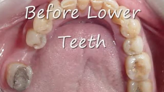 cheema dental smile designing смотреть онлайн