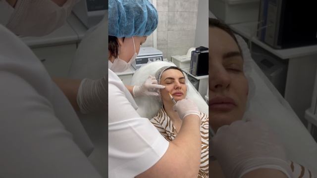 Коррекция носослезной борозды смотреть онлайн