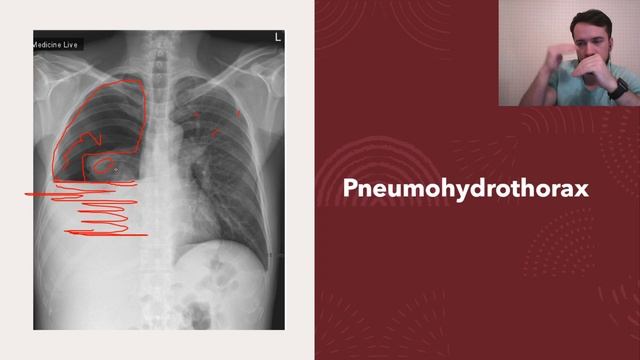 X-ray in surgery/ Рентгенография в хирургии. Научим видеть рентген-картину в двух словах. смотреть онлайн