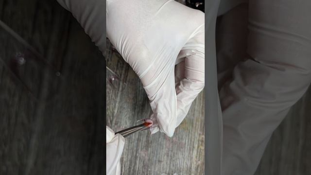 Сильно грифозные ногти исправляем верхними формами смотреть онлайн