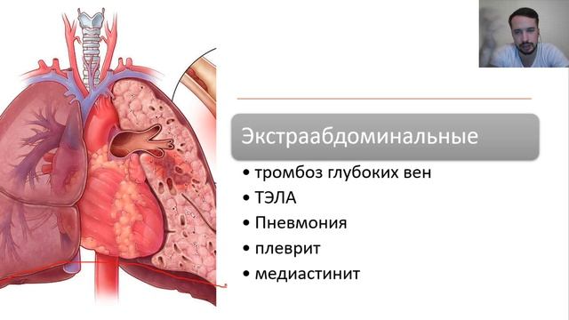 Лекция. Острый перитонит. А бывает хронический? смотреть онлайн
