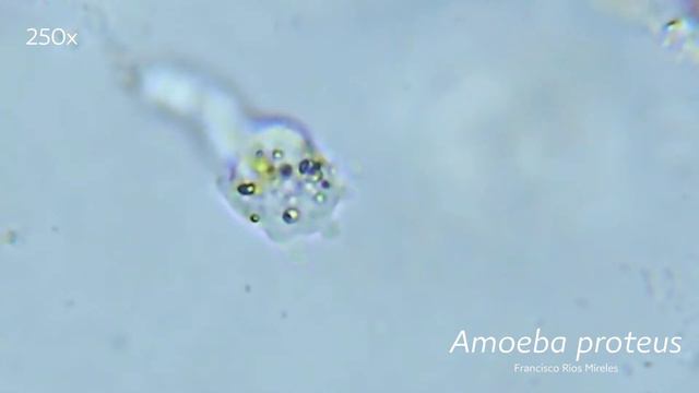 Amoeba proteus under Microscope смотреть онлайн