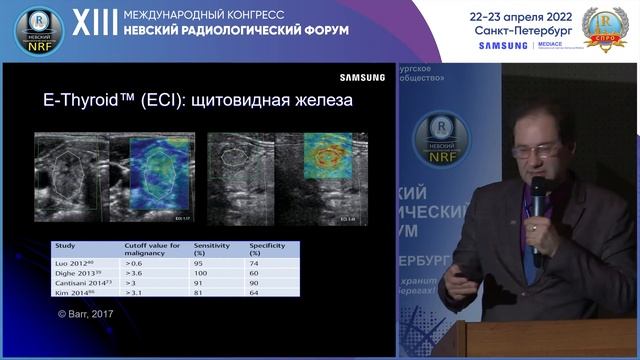 Эластография и CAD технологии на основе искусственного интеллекта смотреть онлайн