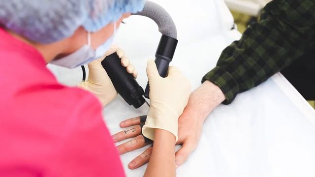 Удаление татуировки лазером До и После в Москве смотреть онлайн