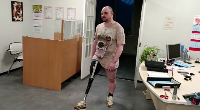 Всё о протезах ног. Часть 3: Тест-драйв коленных модулей в разных городах. Соцсети, почему ВК? смотреть онлайн