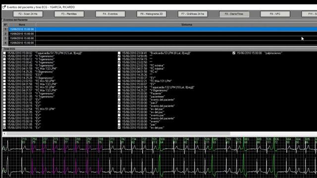 ECCOSUR - Módulo 9 - Post procesamiento, Diario, Tiras y Sumario del estudio Holter HT 103 Eccosur смотреть онлайн