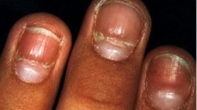 Here’s What The Little Half Moon Under Our Fingernails Means смотреть онлайн