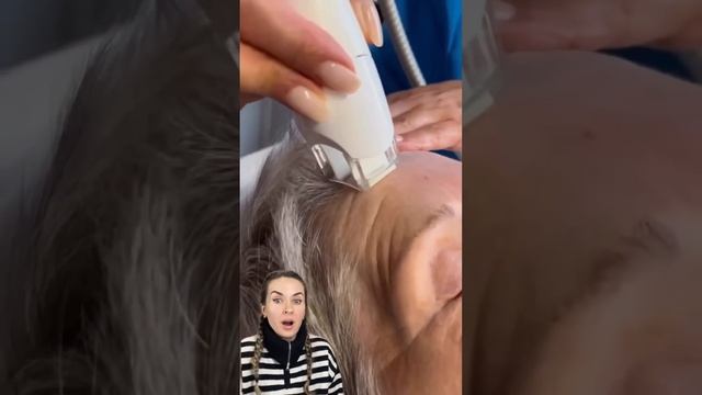 Утюг от морщин ? Невероятно #косметология #губы #уколыкрасоты #пилинг #морщины смотреть онлайн