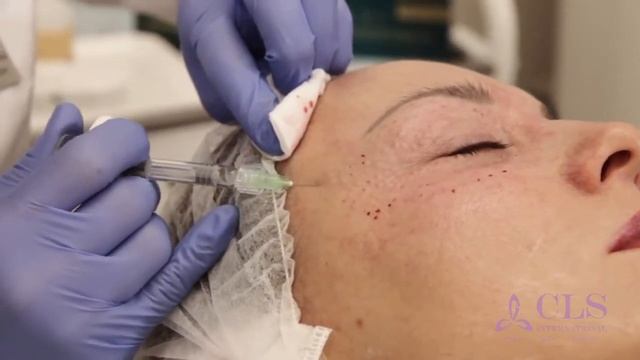 REVI, REVI Strong. Теломерная теория старения. Препараты с содержанием трегалозы. Абдушукурова М.М.