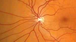 Анатомия (строение глаза)