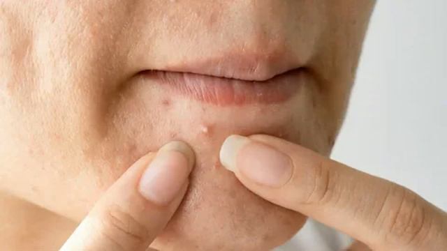 ЧТО КАЖДЫЙ ДОЛЖЕН ЗНАТЬ О... КАПУСТА БЕЛОКОЧАННАЯ, ПОЛЬЗА И ПРОТИВОПОКАЗАНЯ. Народные рецепты. смотреть онлайн