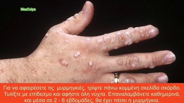 Σκόρδο - 22 απίστευτες χρήσεις смотреть онлайн