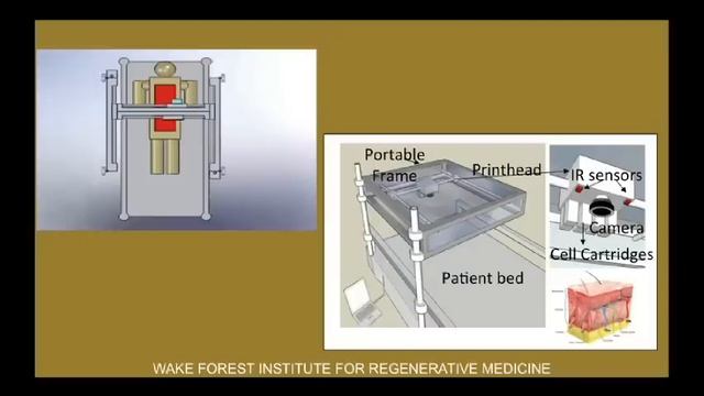 Printing a human kidney | Anthony Atala смотреть онлайн