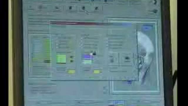 Beautytek Acne Kezelése