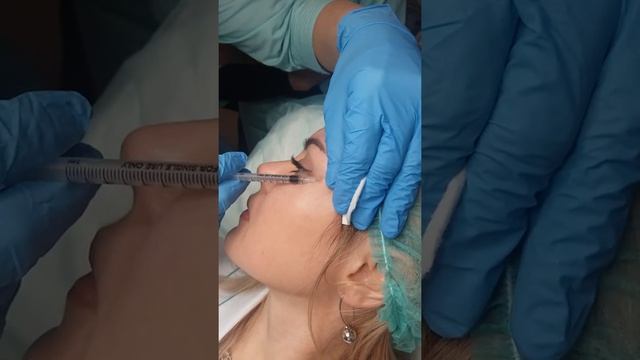 Ботокс гусиные лапки смотреть онлайн