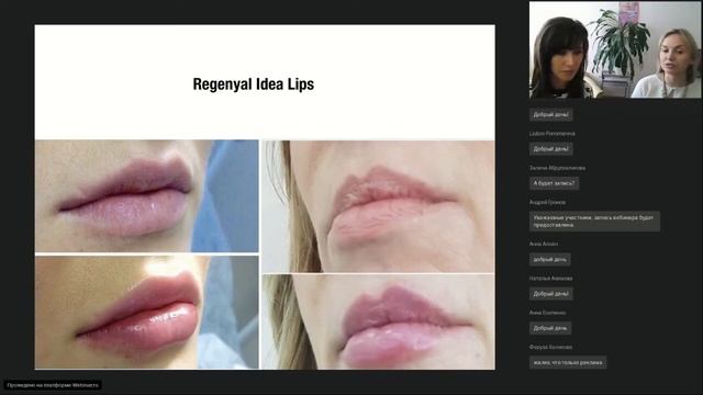 Идеальные губы. Они существуют? смотреть онлайн