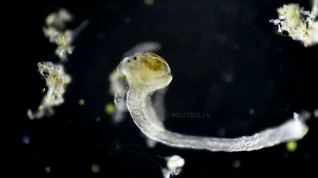 Hydra feeding/ Гидра пожирает рачка смотреть онлайн