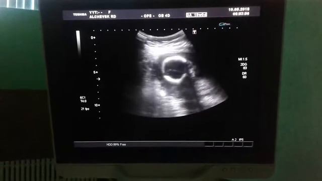 Узи:*) смотреть онлайн