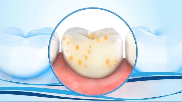 Oral-B | Glazuurerosie - Oorzaken en behandeling смотреть онлайн