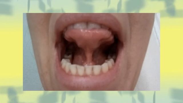 Артикуляционная гимнастика. Часть 2. смотреть онлайн