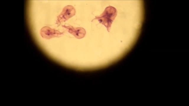 Лямблии под микроскопом