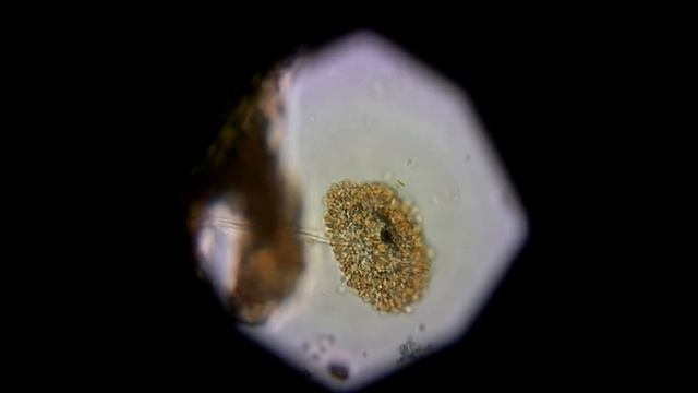 Аспергилл жёлтый (Aspergíllus flavus) смотреть онлайн