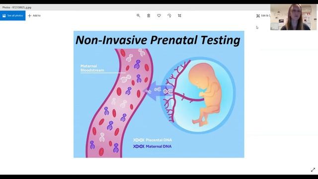 NIPD test: генетический тест по беременности Trisomy 13, 18 и 21 смотреть онлайн