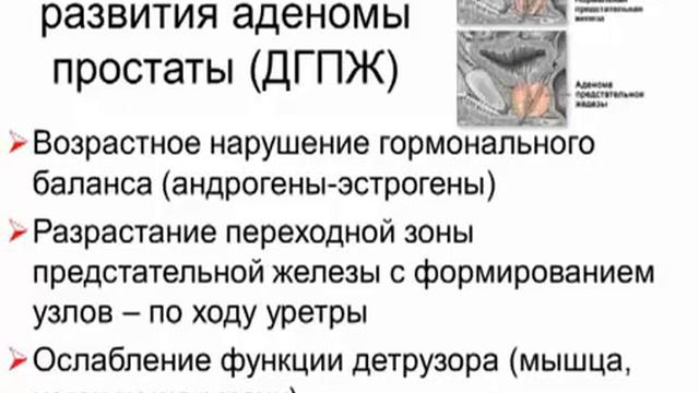 Как лечить хроническую простату смотреть онлайн