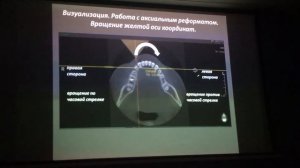 КТ Пикассо