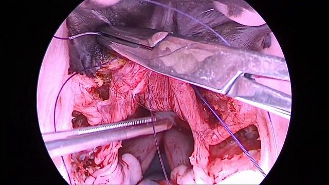How to do a folded flap palatoplasty for BOAS смотреть онлайн