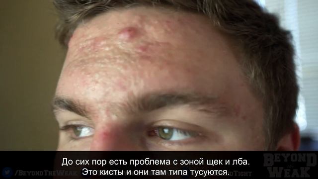 15-ая неделя на Роаккутане. Брайан Тернер смотреть онлайн