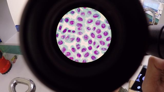 Soğan (Allium sepa) Kök Ucu Preparatında Mitoz Bölünme İncelenmesi, Part II смотреть онлайн