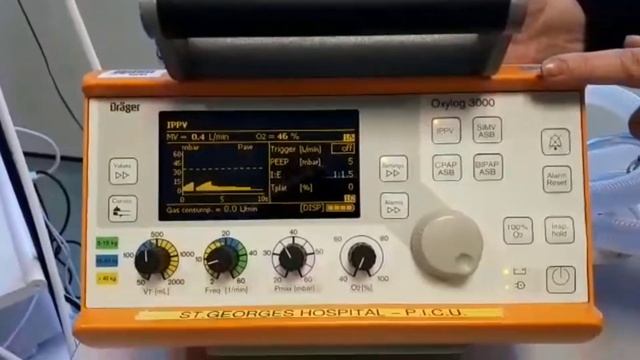 Quick Ventilator Guide: Oxylog 3000 Ventilator смотреть онлайн