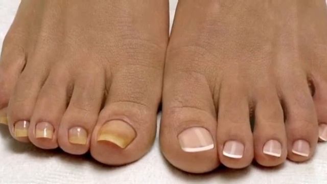Профессиональный медицинский педикюр в салоне nadlen-nail.ru смотреть онлайн