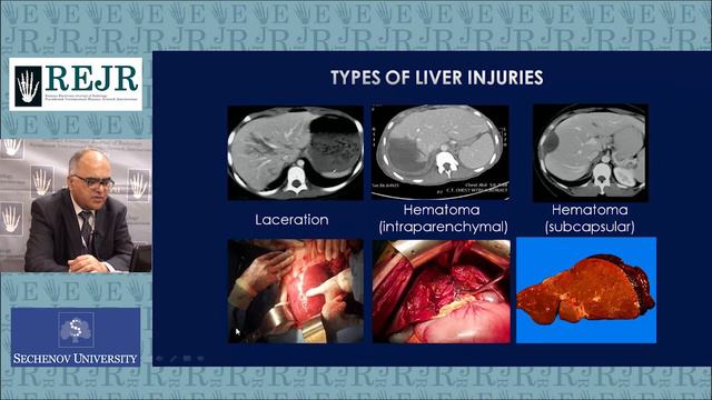 THE ROLE OF CT IN ABDOMINAL TRAUMA смотреть онлайн
