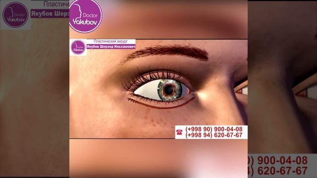 Пластика верхних и нижних век в Ташкенте смотреть онлайн