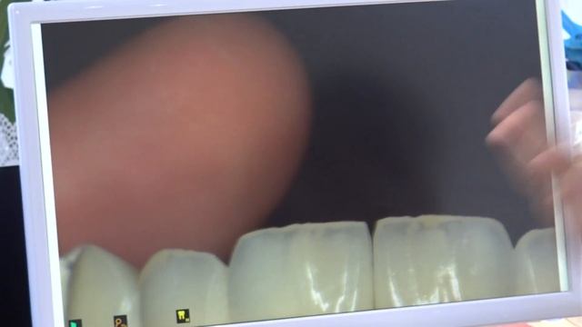 Rashed Mattit with Abdullah Alsaj смотреть онлайн