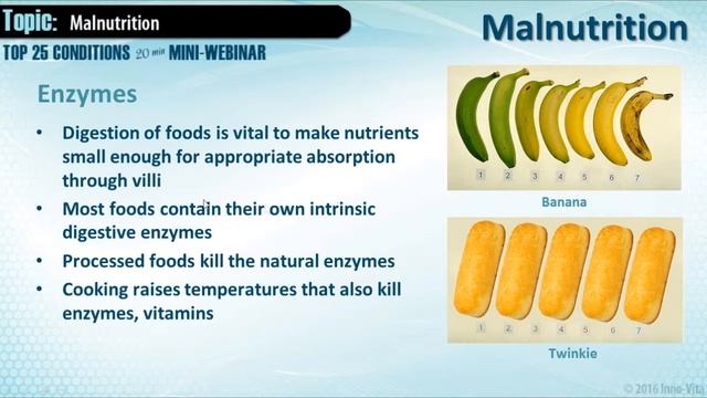 Top 25 Mini-Webinar - Malnutrition смотреть онлайн