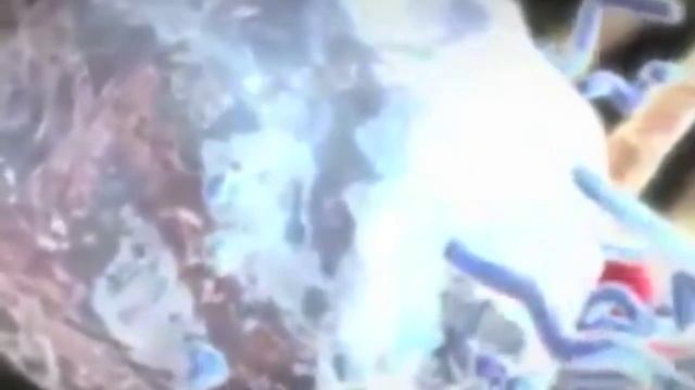 Атеросклероз - как и почему происходит закупорка сосудов смотреть онлайн